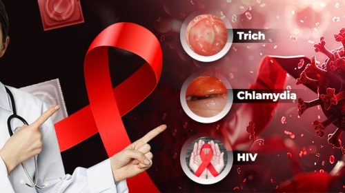 Know about Trich, Chlamydia, and HIV - TAAL Healthcare Blogs